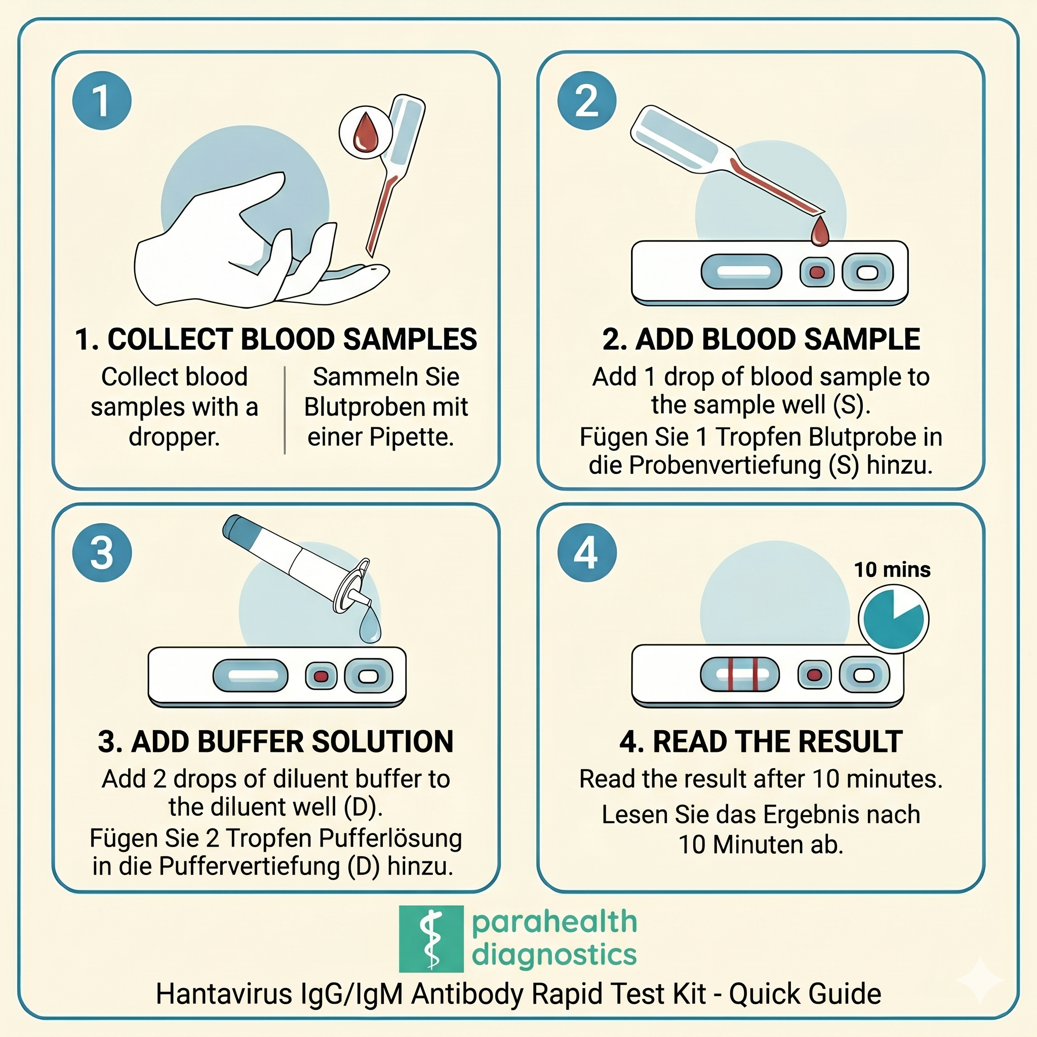 Hantavirus Test — IgG/IgM Antikörper-Schnelltest-Kit